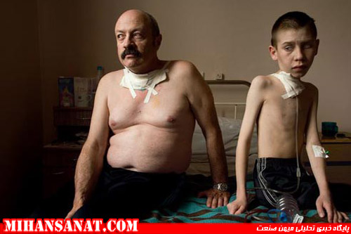http://www.mihansanat.ir/upload/img/radiation-sickness-japan-earthquake-chernobyl-thyroid-cancer_33346_600x450.jpg